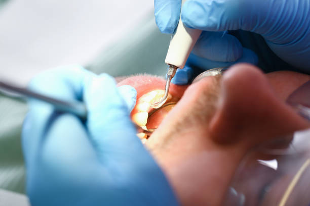 Best Chipped Tooth Repair Near Me  in Edgemont Park, MI