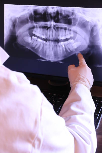 Best Knocked-Out Tooth Emergency  in Edgemont Park, MI