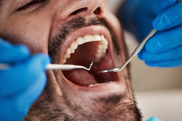 Best Urgent Dental Care  in Edgemont Park, MI