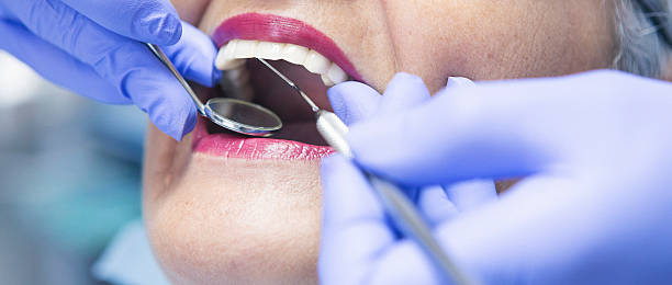 Best Teeth Whitening  in Edgemont Park, MI